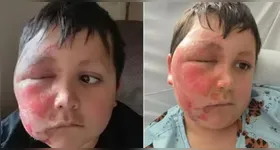 O acidente serve como alerta para que pais reforcem a supervisão sobre o que os filhos consomem nas redes sociais.