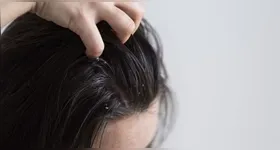 A condição não passa de uma pessoa para outra e não tem relação com falta de higiene. Tanto adultos quanto crianças podem desenvolver o quadro.