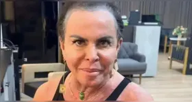 A artista conta, orientada por uma especialista, que utiliza uma prótese especialmente criada para pessoas em tratamento oncológico.