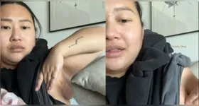 Influenciadora destaca terceiro mamilo