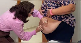 Oferta do remédio pela prefeitura da cidade é via SUS