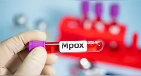 A infecção foi registrada no município de Colatina, no noroeste capixaba.