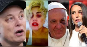 Ivete Sangalo reapareceu em live após cirurgia e tranquilizou fãs sobre recuperação, enquanto teorias conspiratórias sobre o “Olho Roxo” voltaram a circular nas redes.