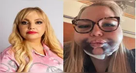 Advogada ficou internada por 12 dias após procedimento estético facial; dentista foi denunciada por lesão corporal grave.