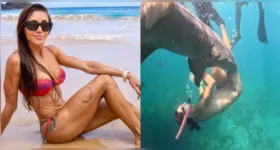 A advogada afirmou que não pretende remover a cicatriz.