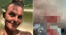 Psicóloga também foi mordida no abdômen e braço.