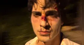 Fiuk compartilha imagem preocupante com rosto machucado e gera reações de fãs