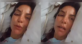 Síndrome vasovagal: entenda condição que fez Ivete Sangalo desmaiar.