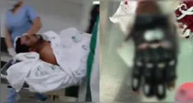 De acordo com informações da Polícia Militar, a vítima foi ferida durante uma briga.