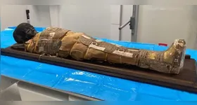 Múmia egípcia de criança submetida a ultrassom e pesquisadores identificam objeto misterioso.