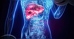 O câncer de pâncreas surge quando células da glândula pancreática passam a se multiplicar de forma descontrolada