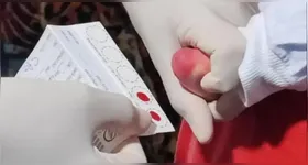 Teste do Pezinho detecta várias doenças, incluindo a toxoplasmose