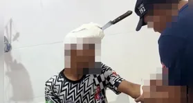 Adolescente de 14 anos ficou com a faca cravada na cabeça.