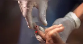 O público infantil concentra cerca de 50% dos casos da doença no país.