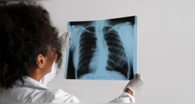 Imagem ilustrativa da notícia Reflexões sobre o 24 de março, Dia Mundial de Combate à Tuberculose