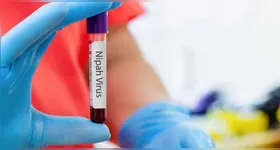 Ministério da Saúde emite alerta sobre o Nipah no Brasil, afirmando que o vírus tem potencial baixo de causar uma nova pandemia.