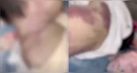 As circunstâncias do caso deverão ser esclarecidas após a conclusão dos exames periciais.