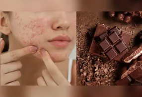 Efeitos do Chocolate na Pele Durante a Páscoa