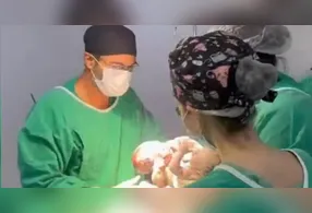 Saiba mais sobre o caso e os próximos passos do tratamento dos siameses