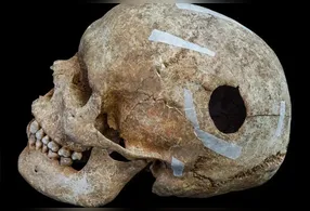 Descoberta de sepulturas de 1.200 anos no Wandlebury Park revela indícios de mortes violentas e práticas funerárias da Idade Média na Inglaterra.