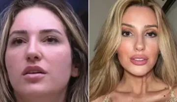 Imagem ilustrativa da imagem Ex-BBB Amanda Meirelles reage às críticas sobre mudanças no rosto