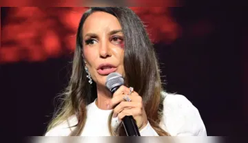 Imagem ilustrativa da imagem VÍDEO: veja como ficou o rosto de Ivete Sangalo após cirurgia