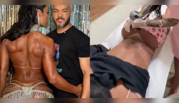 Imagem ilustrativa da imagem Gracyanne Barbosa começar a remover tatuagem em homenagem a Belo