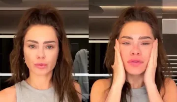 Imagem ilustrativa da imagem Dermatologista explica mudanças no rosto de Carolina Dieckmann