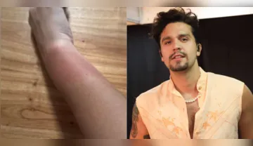 Imagem ilustrativa da imagem Fãs relatam queimaduras por pulseiras de LED em show de Luan Santana