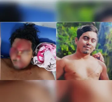 Imagem ilustrativa da imagem Homem fica ferido em acidente com serra elétrica em Portel