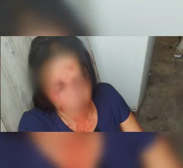 Imagem ilustrativa da imagem Homem agride e desfigura o rosto da companheira no Reduto, em Belém