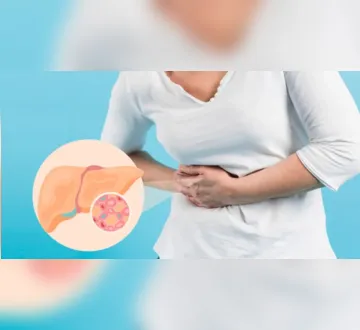 Imagem ilustrativa da imagem Gordura no fígado: hepatologista revela os 6 sintomas mais comuns