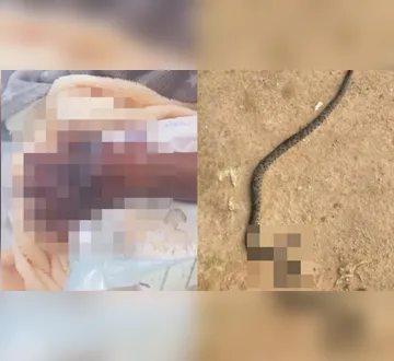Imagem ilustrativa da imagem Criança de 5 anos é internada após picada de cobra no Pará