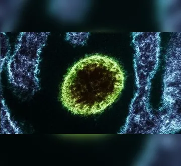 Imagem ilustrativa da imagem Nipah: conheça o vírus com alta mortalidade que causou surto na Índia