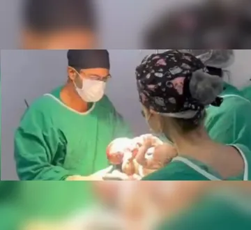 Imagem ilustrativa da imagem Cirurgia de separação termina com morte de gêmeos siameses&nbsp;