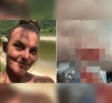 Imagem ilustrativa da imagem Capivara ataca e arranca pedaço de nádega de mulher, em Florianópolis