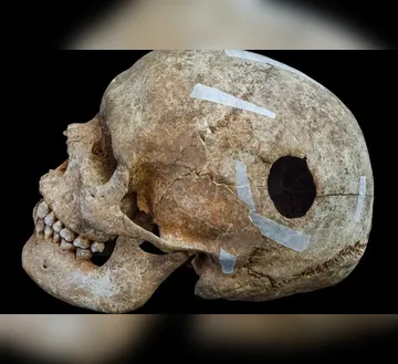 Imagem ilustrativa da imagem Descoberta macabra revela mortes horríveis de 1200 anos