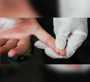 Imagem ilustrativa da imagem SUS oferece teste rápido para dengue com resultado em minutos