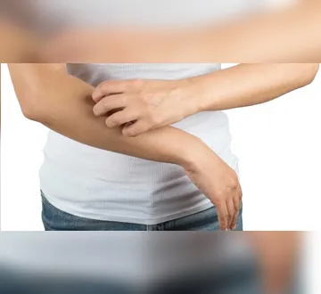 Imagem ilustrativa da imagem Esses são os sinais na pele que podem indicar gordura no fígado