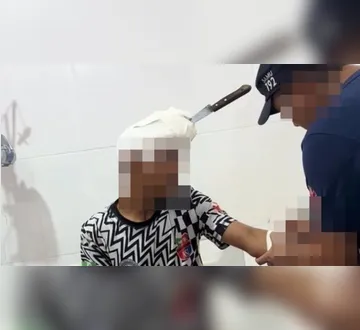 Imagem ilustrativa da imagem Briga de irmãos termina com faca cravada na cabeça no Marajó