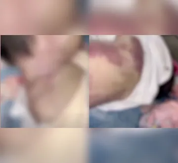 Imagem ilustrativa da imagem Criança de 2 meses é encontrada morta com diversas marcas pelo corpo