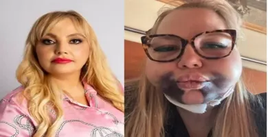 Imagem ilustrativa da imagem Dentista é denunciada após procedimento deformar rosto de advogada