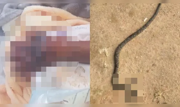 Imagem ilustrativa da imagem Criança de 5 anos é internada após picada de cobra no Pará