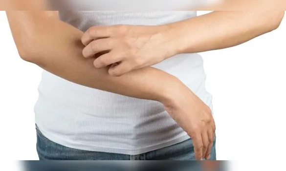 Imagem ilustrativa da imagem Esses são os sinais na pele que podem indicar gordura no fígado