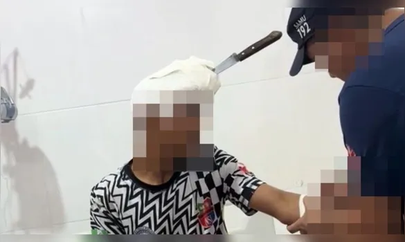 Imagem ilustrativa da imagem Briga de irmãos termina com faca cravada na cabeça no Marajó