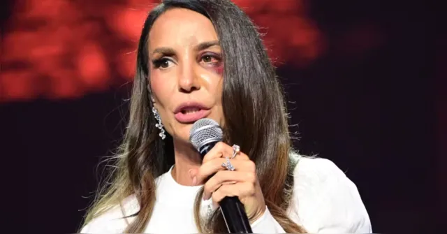 Imagem ilustrativa da notícia VÍDEO: veja como ficou o rosto de Ivete Sangalo após cirurgia