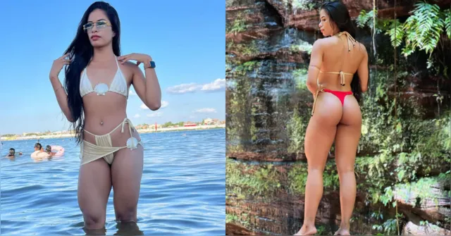 Imagem ilustrativa da notícia Influenciadora paraense morre após complicações de cirurgia plástica