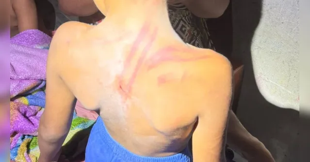 Imagem ilustrativa da notícia Mãe é presa por agredir três filhos com fio elétrico em Marituba