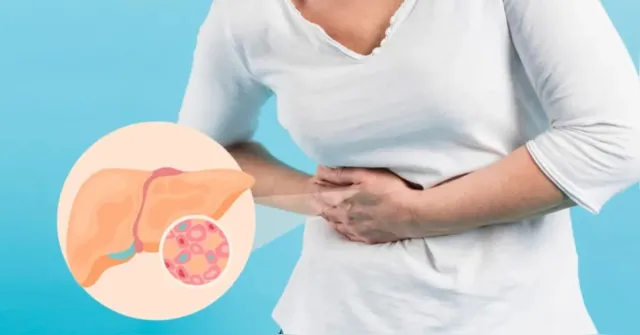 Imagem ilustrativa da notícia Gordura no fígado: hepatologista revela os 6 sintomas mais comuns