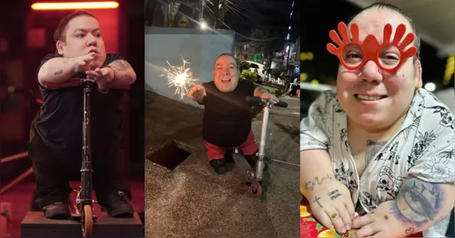 Imagem ilustrativa da notícia Morre Alejo Little, “um dos menores influenciadores do mundo”